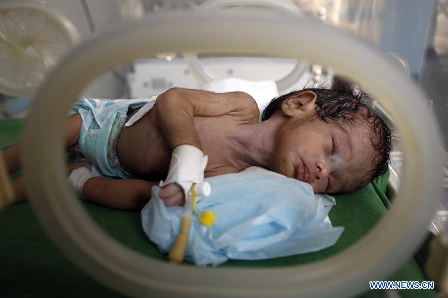 YEMEN-SANAA-WAR-TORN ZONE-BABIES